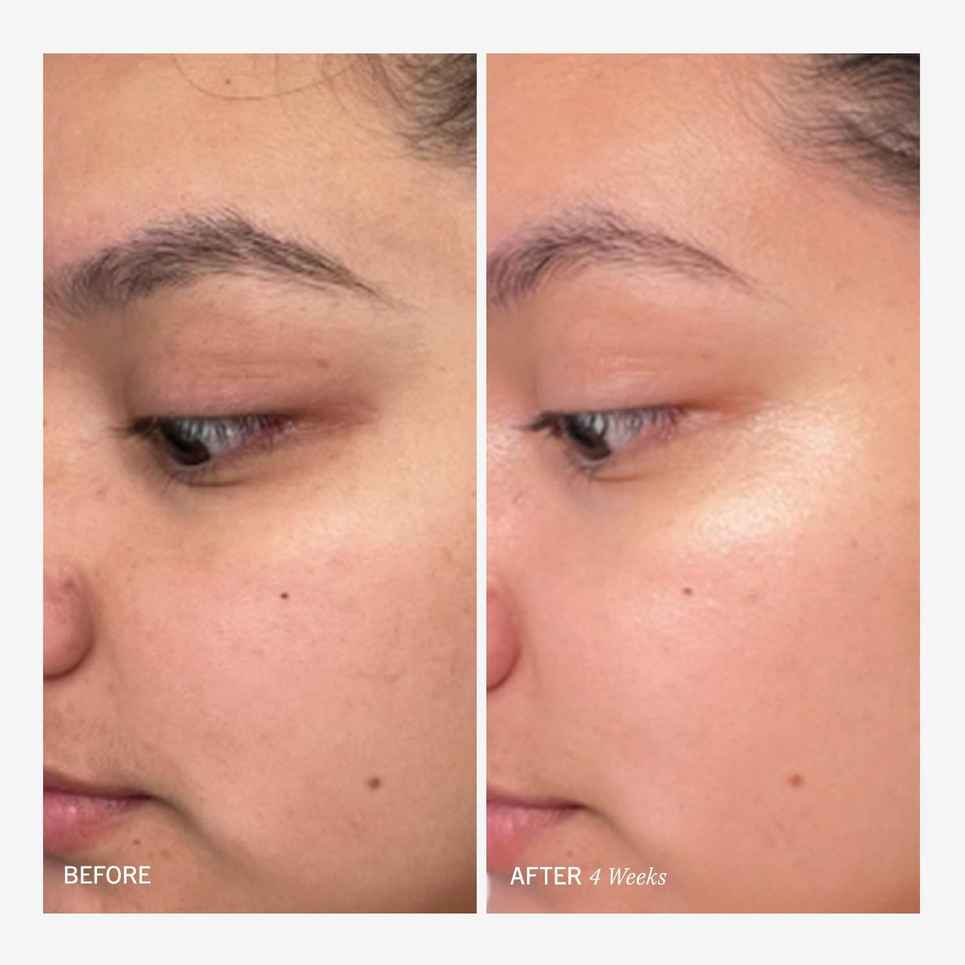 Facial Radiance Pads