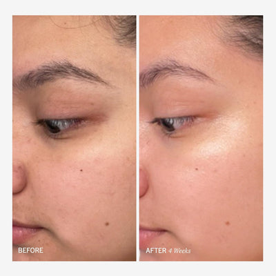 Facial Radiance Pads