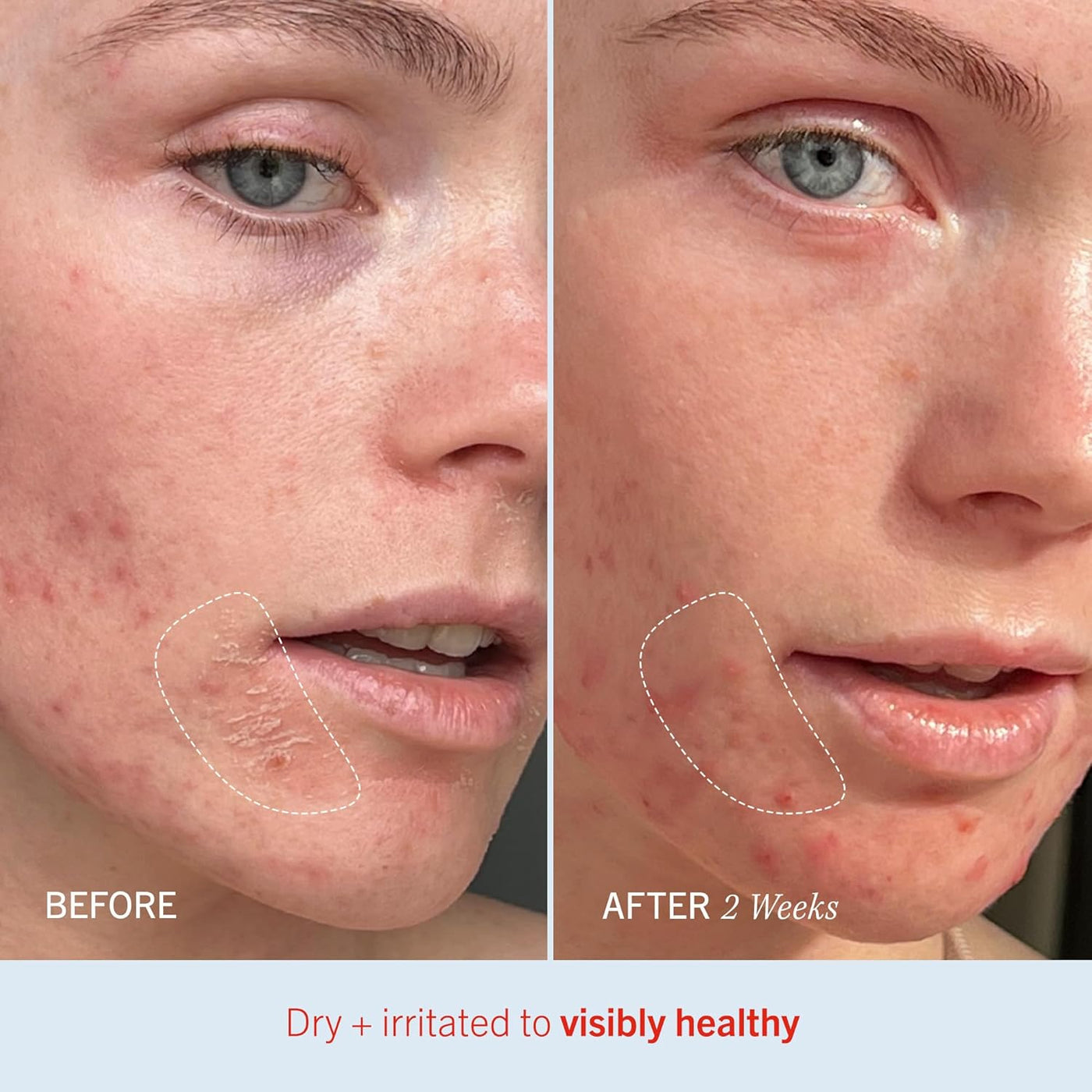 Ultra Repair Cream