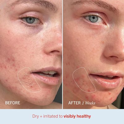 Ultra Repair Cream